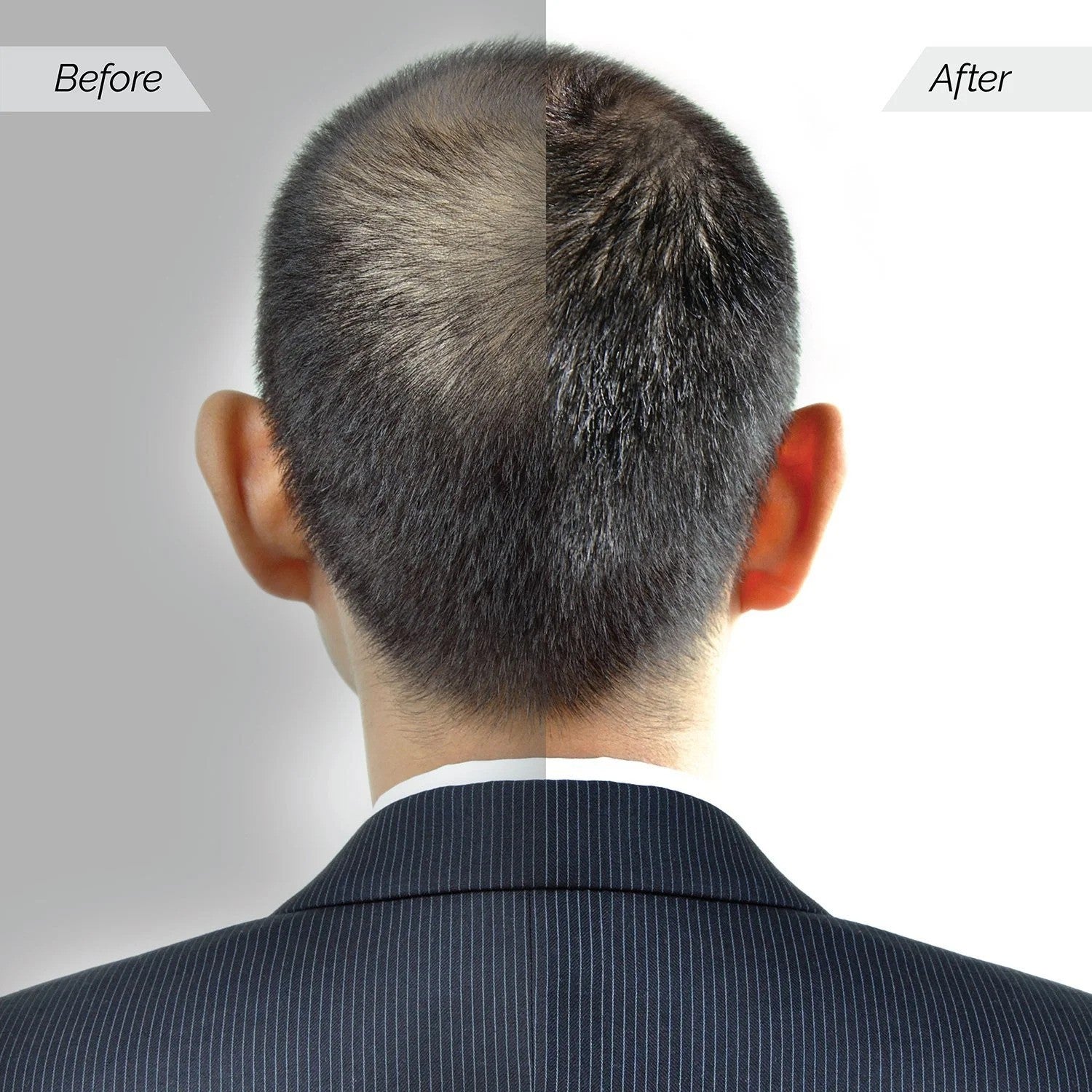 Before and after comparison of a person's hair on the back of their head.