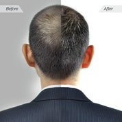 Before and after comparison of a person's hair on the back of their head.